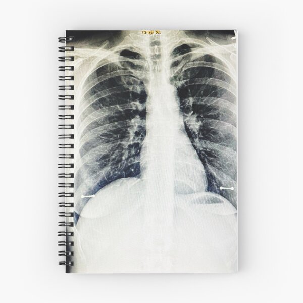 Item preview, Pneumonia nipple X-ray designed and sold by ZelSells.