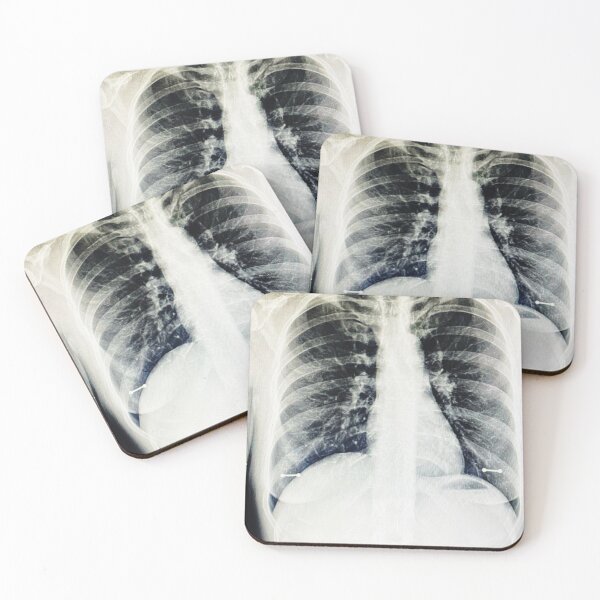 Item preview, Pneumonia nipple X-ray designed and sold by ZelSells.