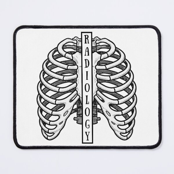 Item preview, Radiology Rib Cage designed and sold by Beautiful Inheritance.