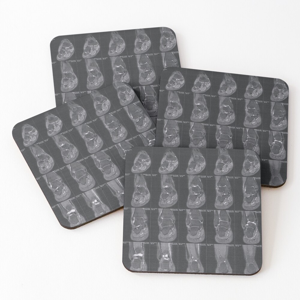 Item preview, Coasters (Set of 4) designed and sold by -TAZ-.