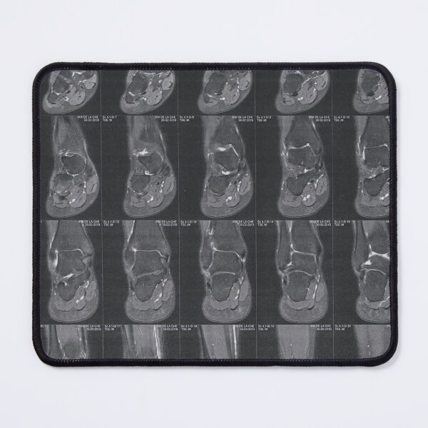 Item preview, MRI designed and sold by ATOM by TAZ.