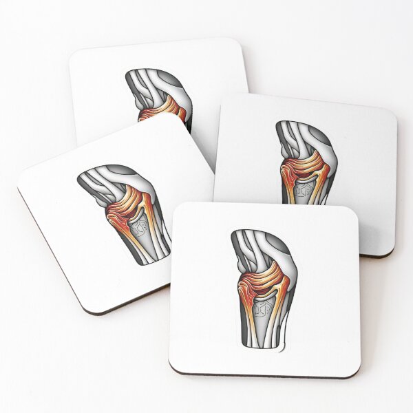 Item preview, Knee Joint Anatomy Diagram Retro Arcade Style – Medical Orthopedic Illustration designed and sold by astersgraphics.