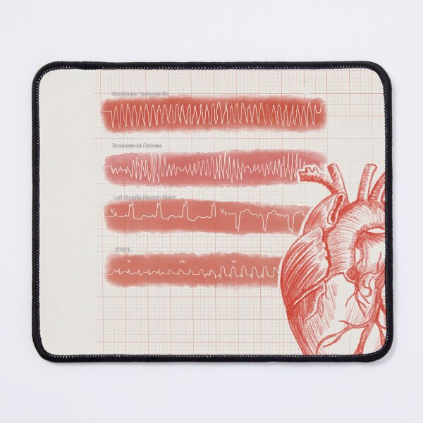 Item preview, EKG Rhythms designed and sold by Spilled--Ink.