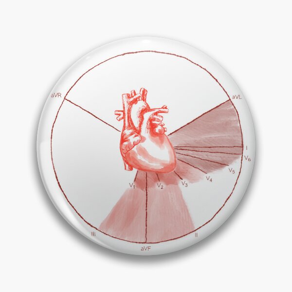 Item preview, EKG Myocardial Infarction Localization designed and sold by Spilled--Ink.