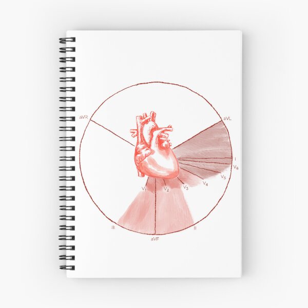 Item preview, EKG Myocardial Infarction Localization designed and sold by Spilled--Ink.