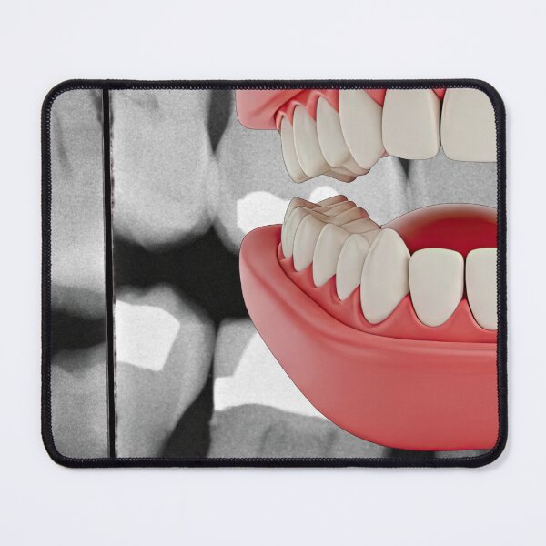 Item preview, OUCH designed and sold by GVSZM.