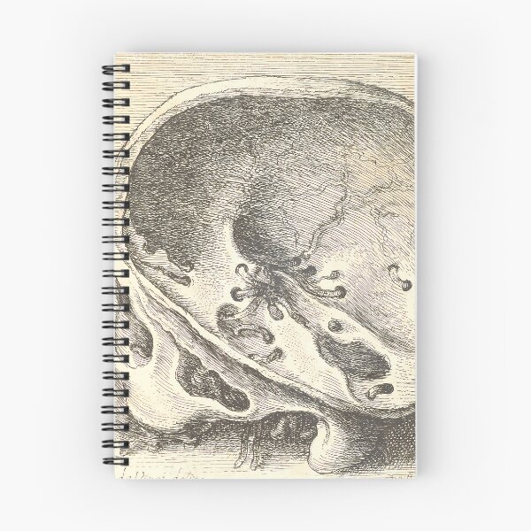 Item preview, Hollar Sectioned Skull | Anatomy Art designed and sold by GammaRay.