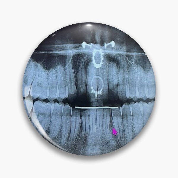 Item preview, Pierced at the dentist designed and sold by McKennaJBailey.