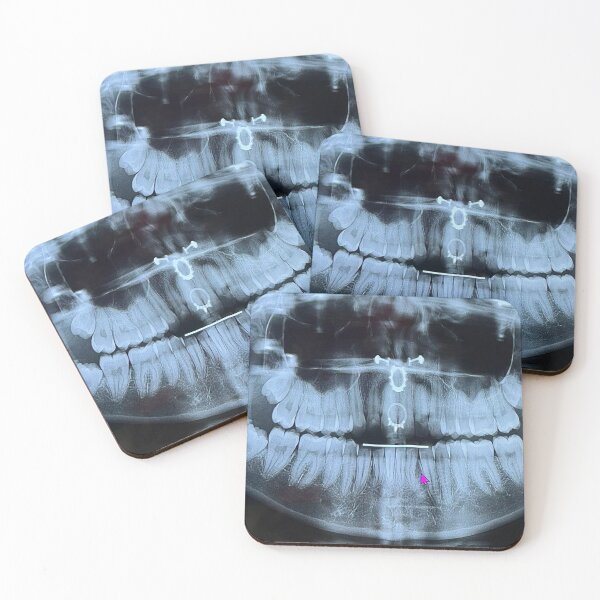 Item preview, Pierced at the dentist designed and sold by McKennaJBailey.