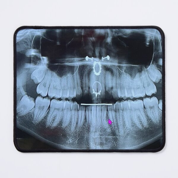 Item preview, Pierced at the dentist designed and sold by McKennaJBailey.