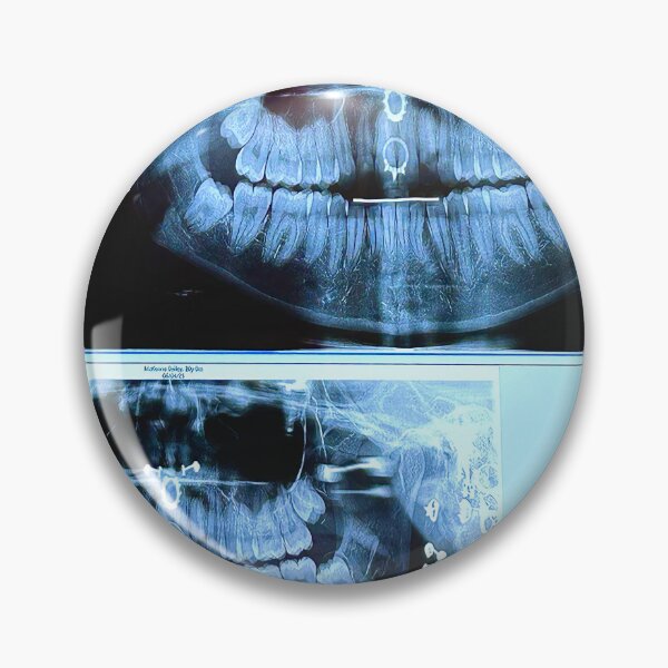 Item preview, piercings under an X-ray designed and sold by McKennaJBailey.