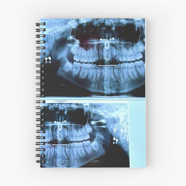 Item preview, piercings under an X-ray designed and sold by McKennaJBailey.