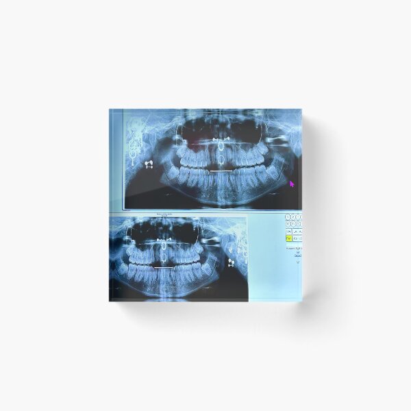 Item preview, piercings under an X-ray designed and sold by McKennaJBailey.