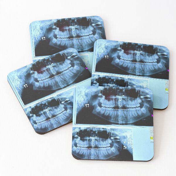 Item preview, piercings under an X-ray designed and sold by McKennaJBailey.