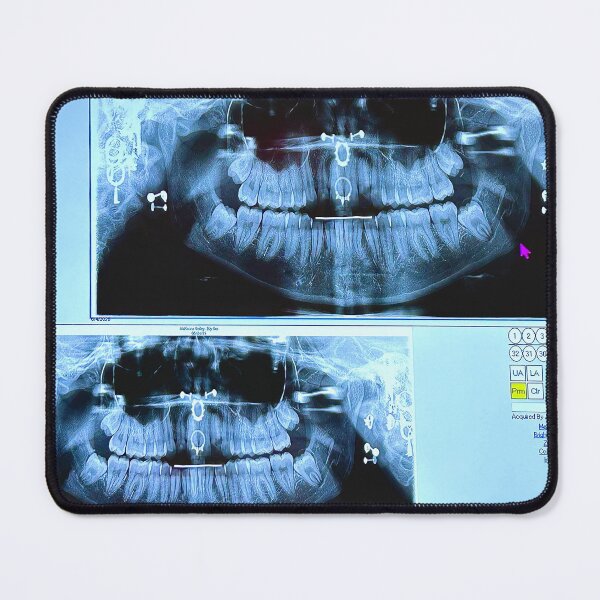 Item preview, piercings under an X-ray designed and sold by McKennaJBailey.