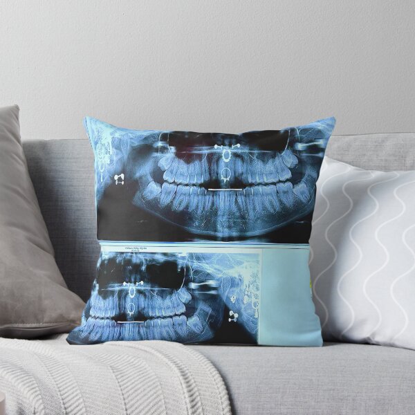 Item preview, piercings under an X-ray designed and sold by McKennaJBailey.