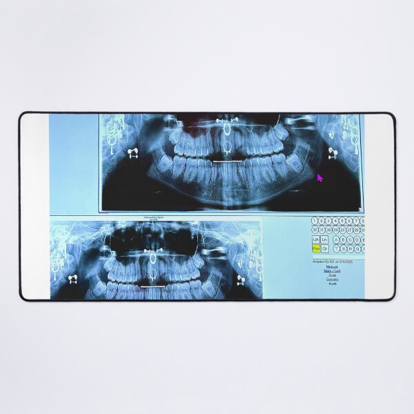 Item preview, piercings under an X-ray designed and sold by McKennaJBailey.