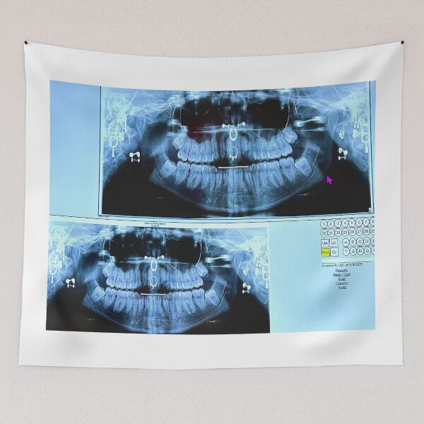Item preview, piercings under an X-ray designed and sold by McKennaJBailey.