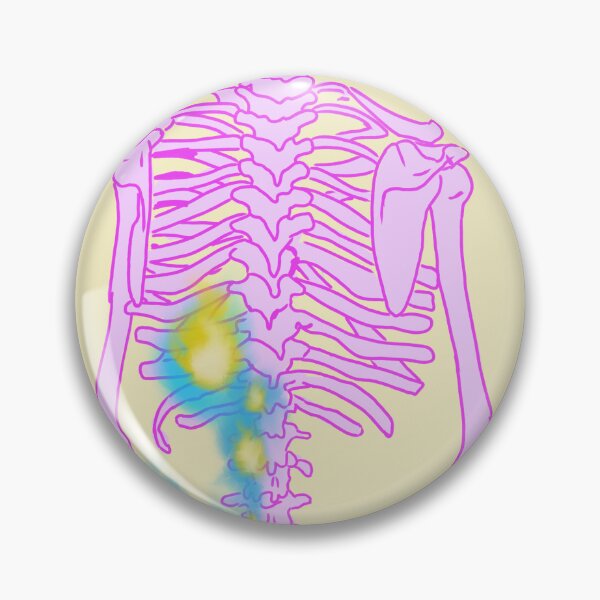 Item preview, Skeleton with lower back on fire designed and sold by mousse-tache.