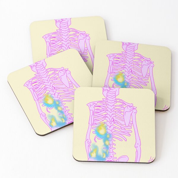Item preview, Skeleton with lower back on fire designed and sold by mousse-tache.