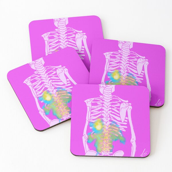Item preview, Skeleton with lower back on fire designed and sold by mousse-tache.