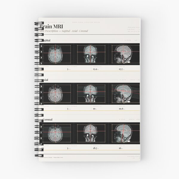 Item preview, MRI Brain Slice Prescription designed and sold by MRInterested.