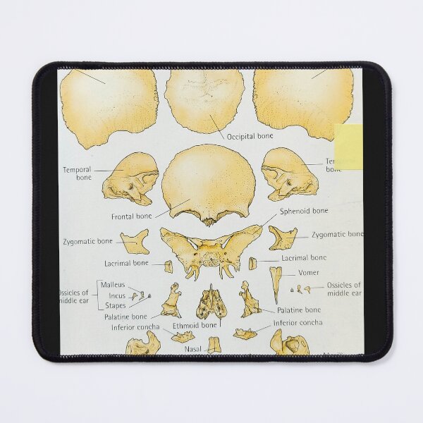 Item preview, exploding skull  designed and sold by Cedartown.