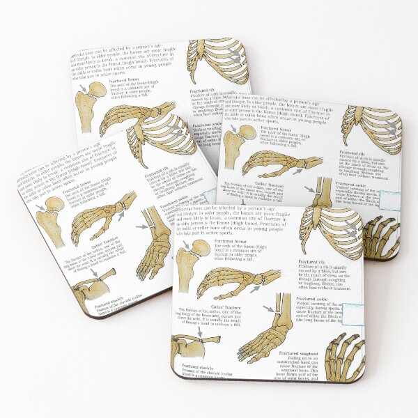 Item preview, anatomical bones drawings designed and sold by Cedartown.