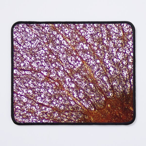 Item preview, Penis Histology Image designed and sold by trabeculae carneae.