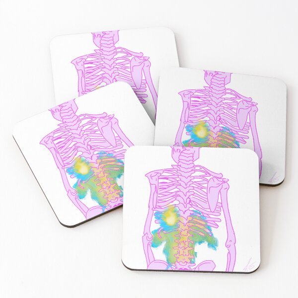 Item preview, Skeleton with lower back on fire designed and sold by mousse-tache.