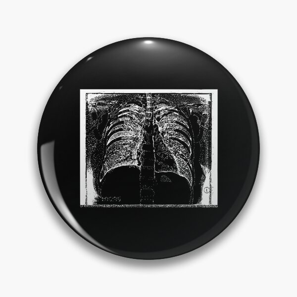 Item preview, Chest X-Ray - Light Lines designed and sold by The Stippler Process.