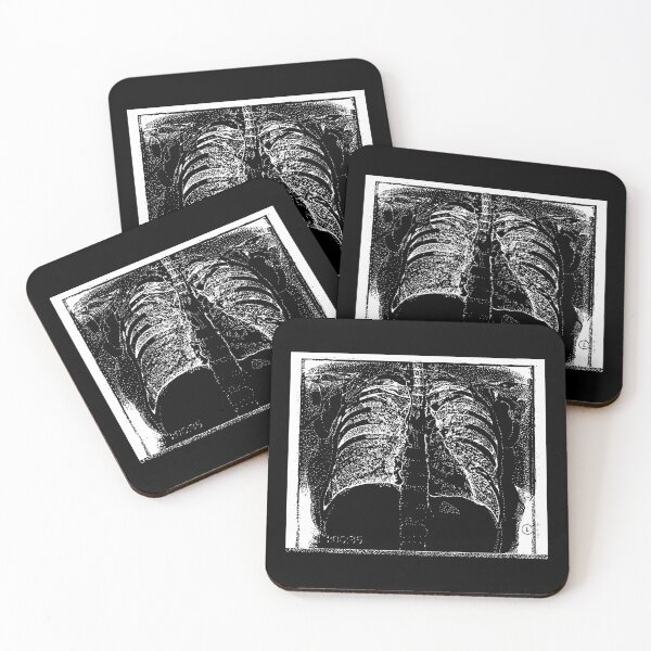 Item preview, Chest X-Ray - Light Lines designed and sold by The Stippler Process.