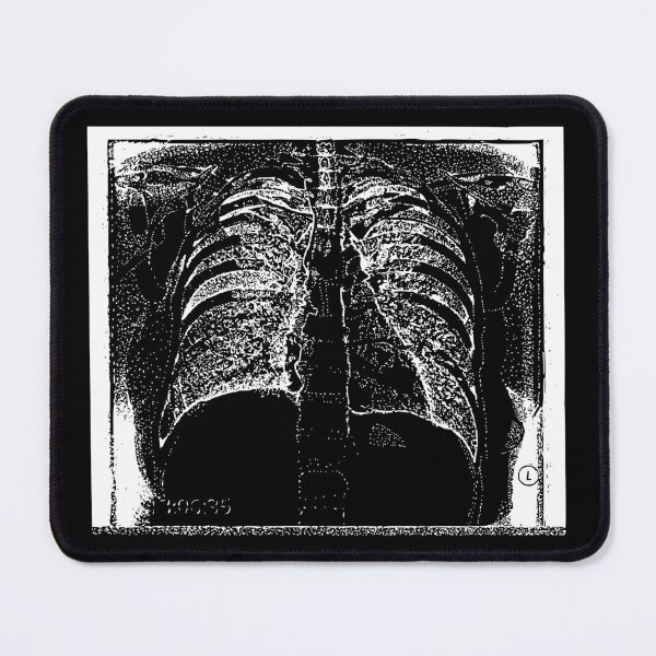 Item preview, Chest X-Ray - Light Lines designed and sold by The Stippler Process.