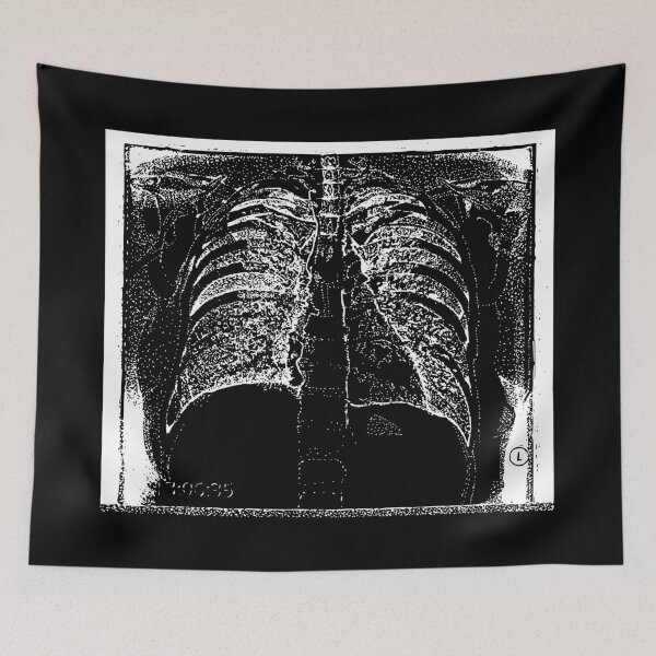 Item preview, Chest X-Ray - Light Lines designed and sold by The Stippler Process.