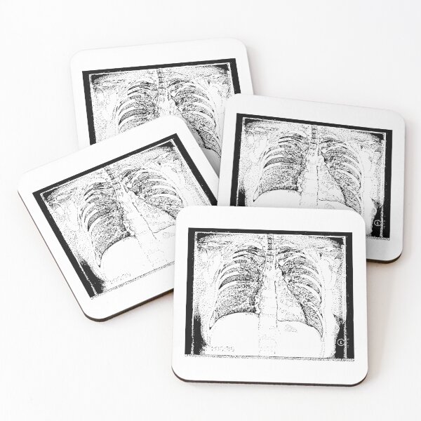 Item preview, Chest X-Ray designed and sold by The Stippler Process.