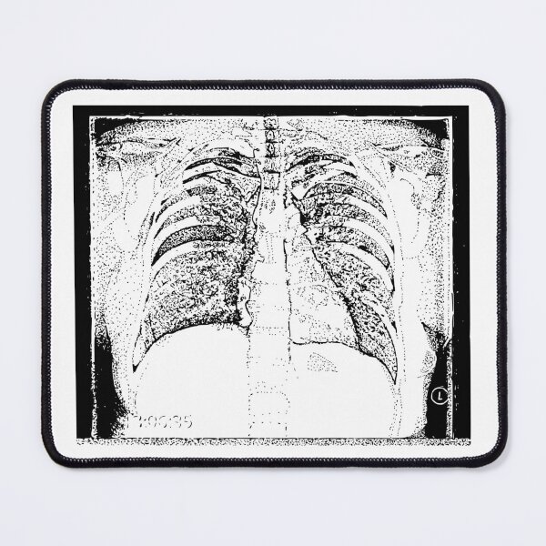 Item preview, Chest X-Ray designed and sold by The Stippler Process.