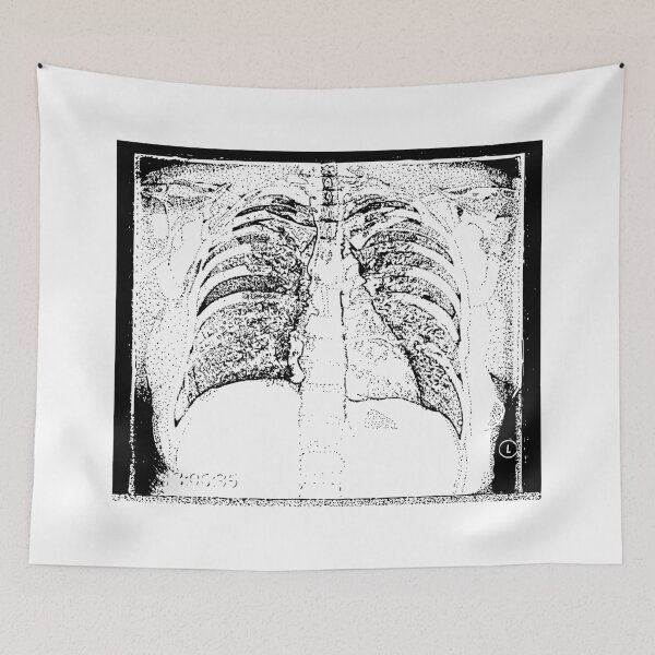 Item preview, Chest X-Ray designed and sold by The Stippler Process.