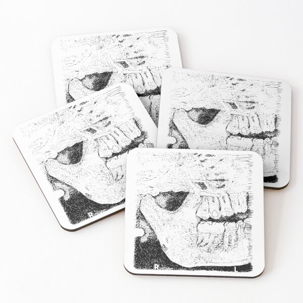 Item preview, Sweet Tooth X-Ray designed and sold by The Stippler Process.