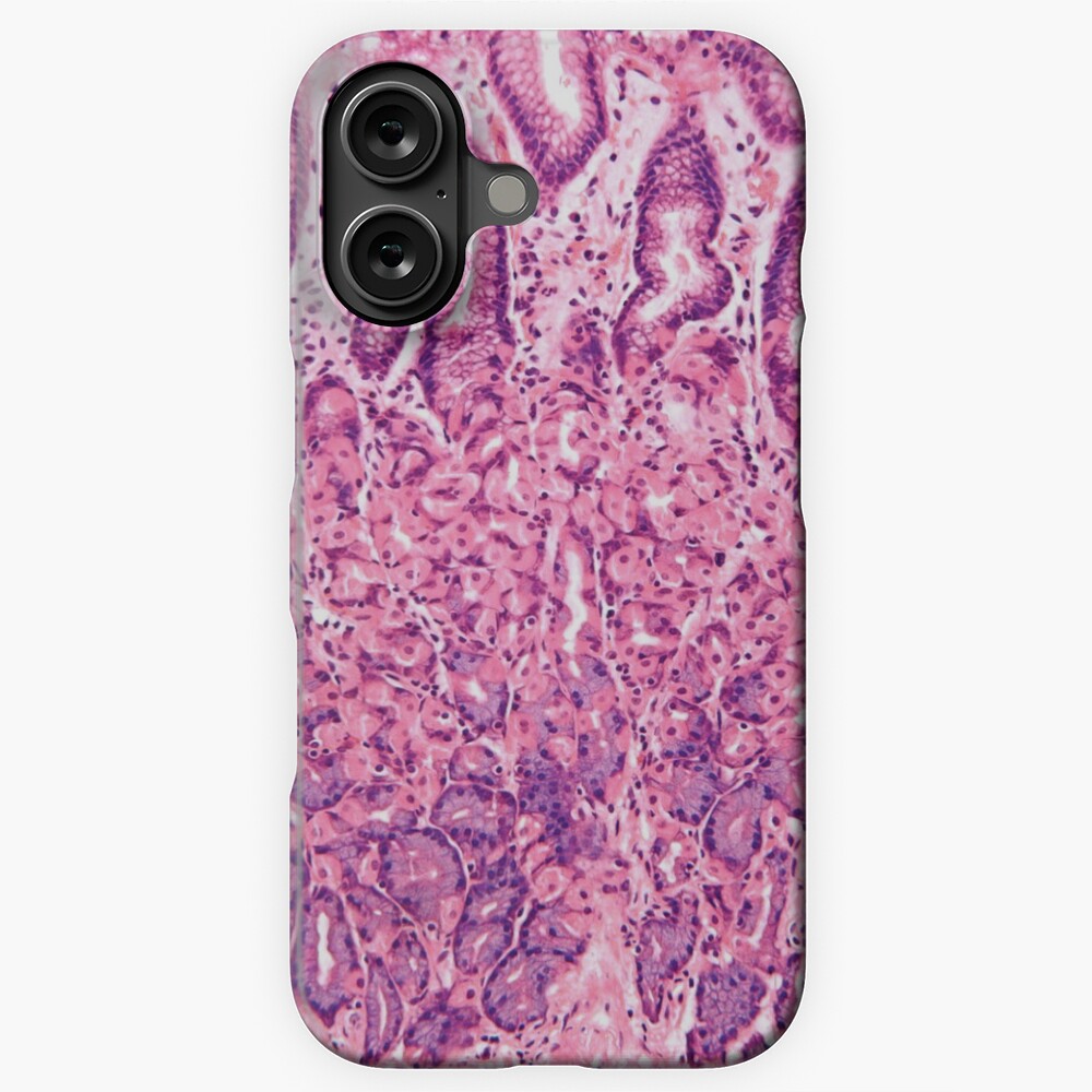 Aperçu de l'œuvre Coque rigide iPhone créée et vendue par deltoid.