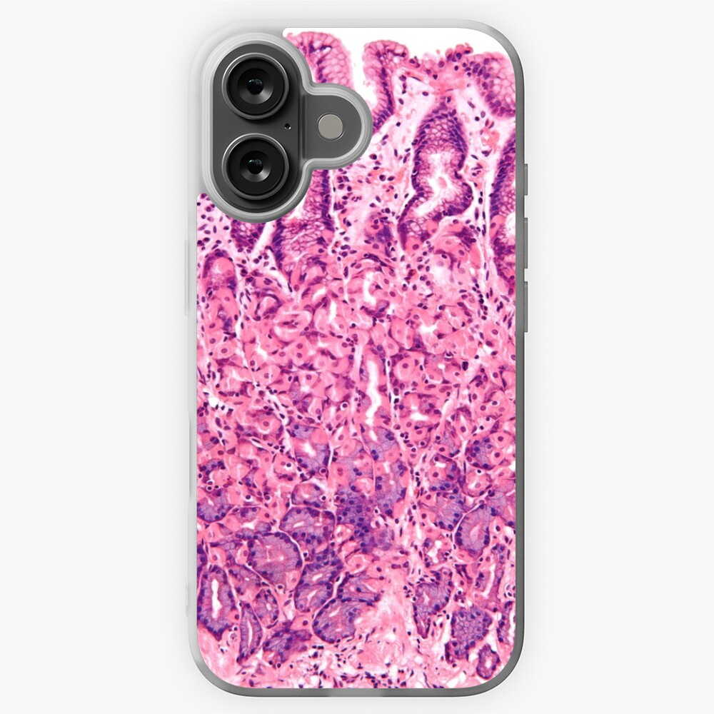 Aperçu de l'œuvre Coque souple iPhone créée et vendue par deltoid.