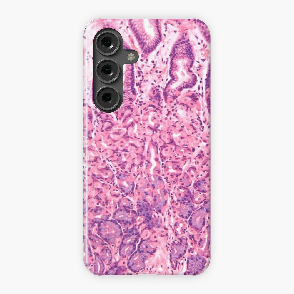 Aperçu de l'œuvre Coque rigide Samsung Galaxy créée et vendue par deltoid.
