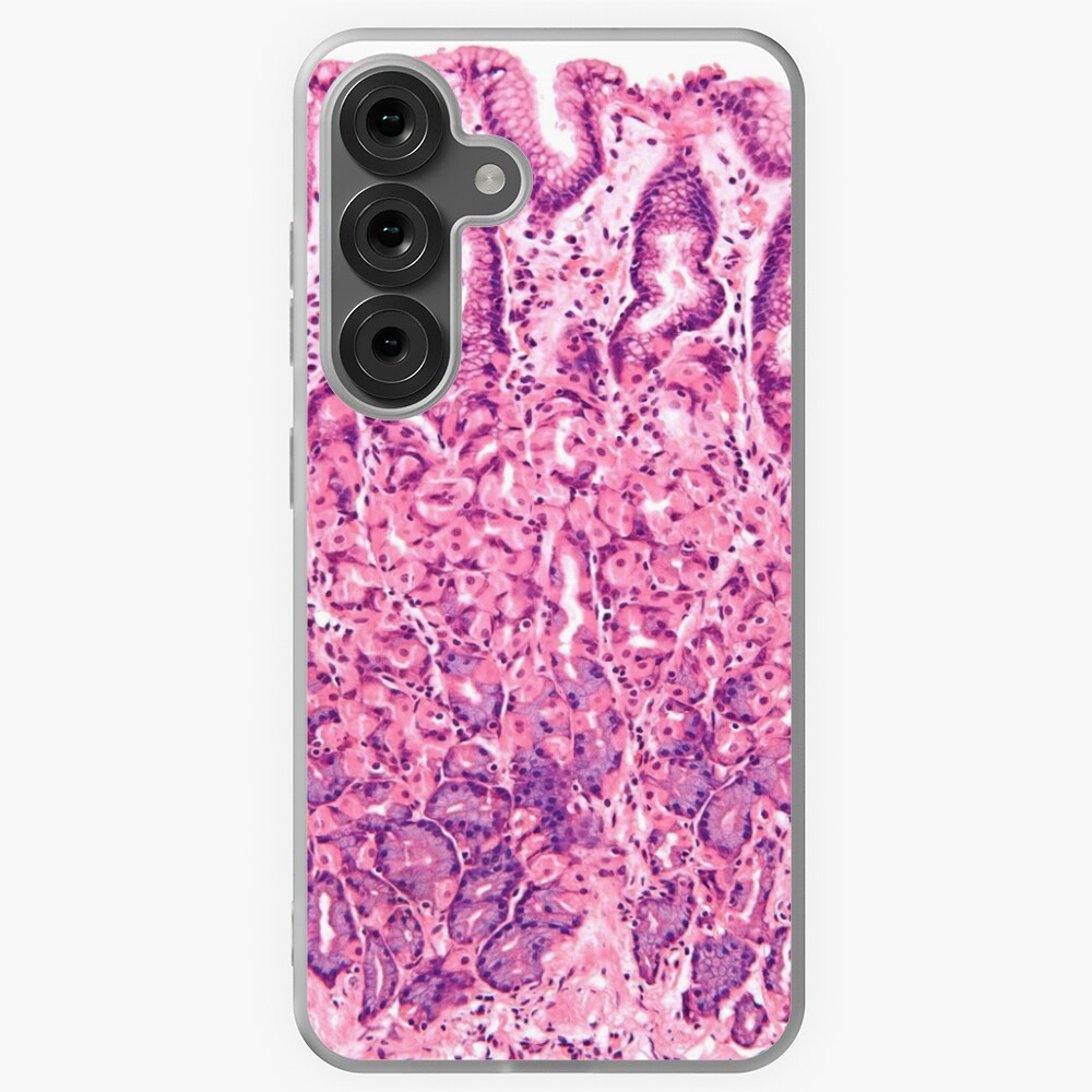 Aperçu de l'œuvre Coque souple Samsung Galaxy créée et vendue par deltoid.