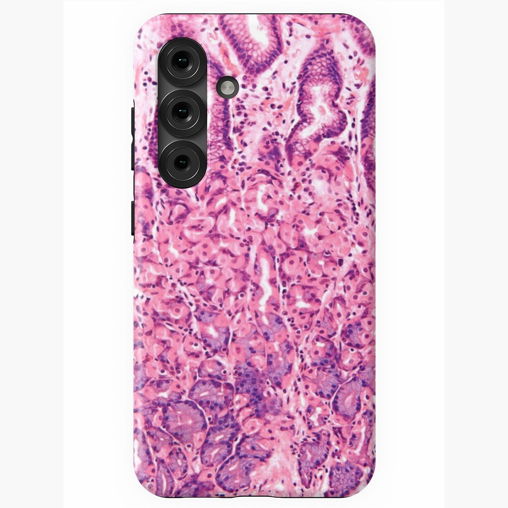 Aperçu de l'œuvre Coque antichoc Samsung Galaxy créée et vendue par deltoid.