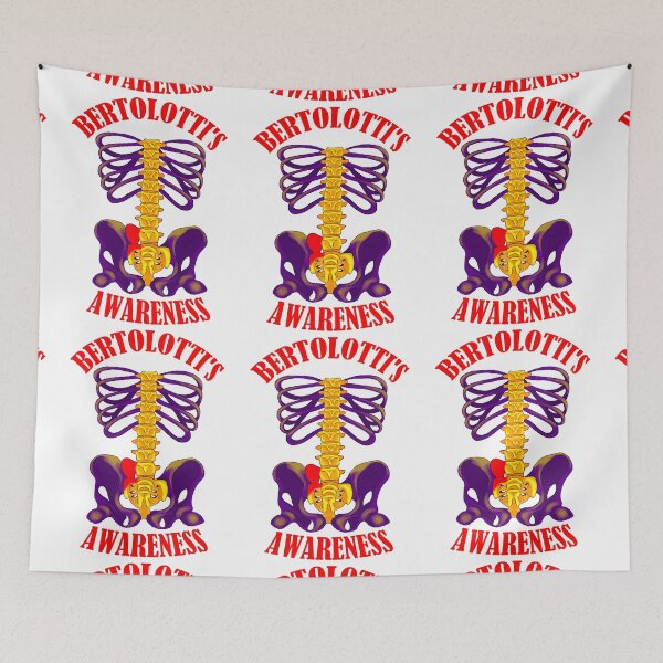 Item preview, Bertolotti's Syndrome.  designed and sold by cameoivory.