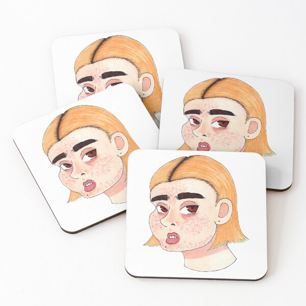 Item preview, Acne Girl designed and sold by sometimesfinishesart.