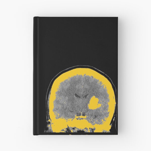 Item preview, StrokeBrain™. I Am Still Here designed and sold by Valerie Asher LLC.