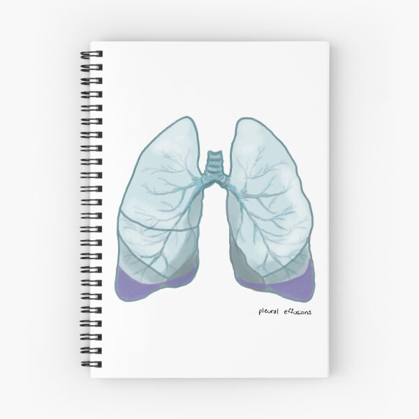 Item preview, Pleural Effusions designed and sold by ascherf.