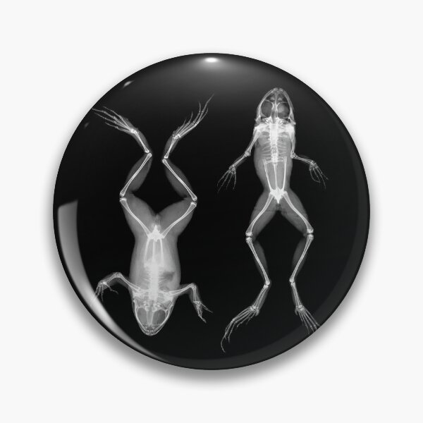 Item preview, Frogs in Prone and Supine Positions (Frösche in Bauch- und Rückenlage) designed and sold by The Ravens Ballad.