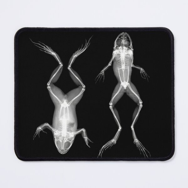 Item preview, Frogs in Prone and Supine Positions (Frösche in Bauch- und Rückenlage) designed and sold by Ravens Ballad.