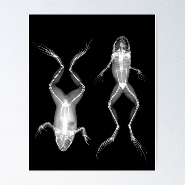Item preview, Frogs in Prone and Supine Positions (Frösche in Bauch- und Rückenlage) designed and sold by Ravens Ballad.